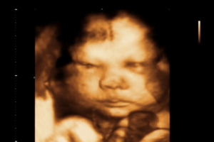 Ecografias Norte 7 Ecografias Norte